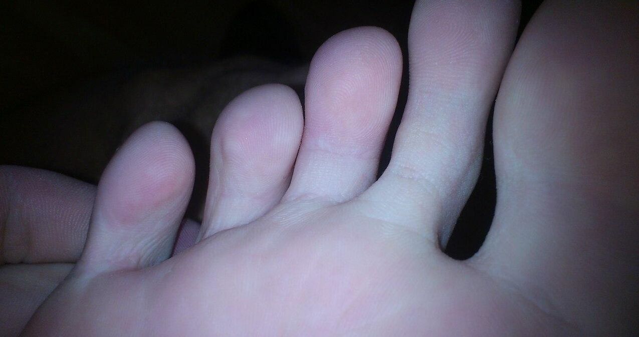 Ho guarito il fungo tra la crema di dito zxcvbnmqwert